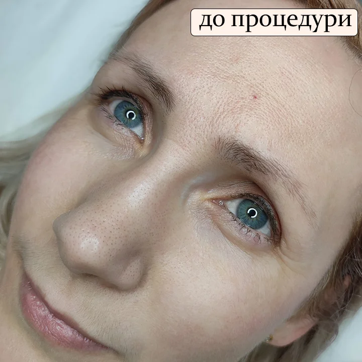 Татуаж брів. До процедури. Львів