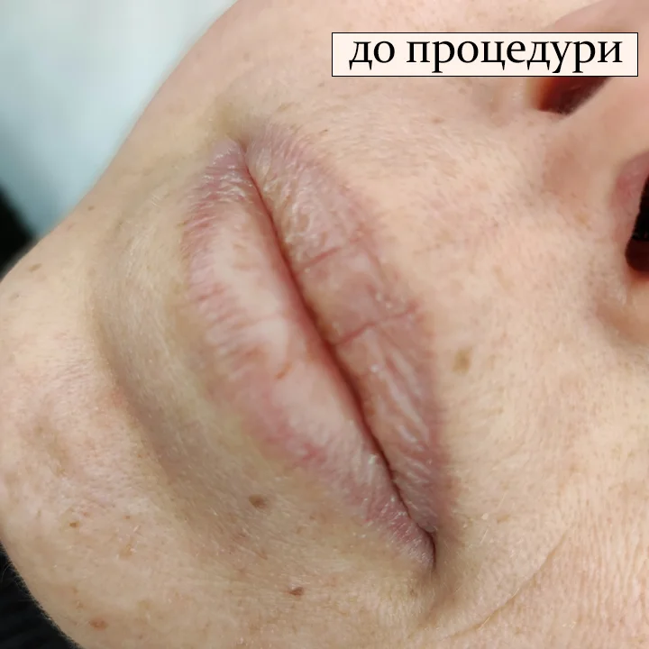 До процедури татуажу. Львів