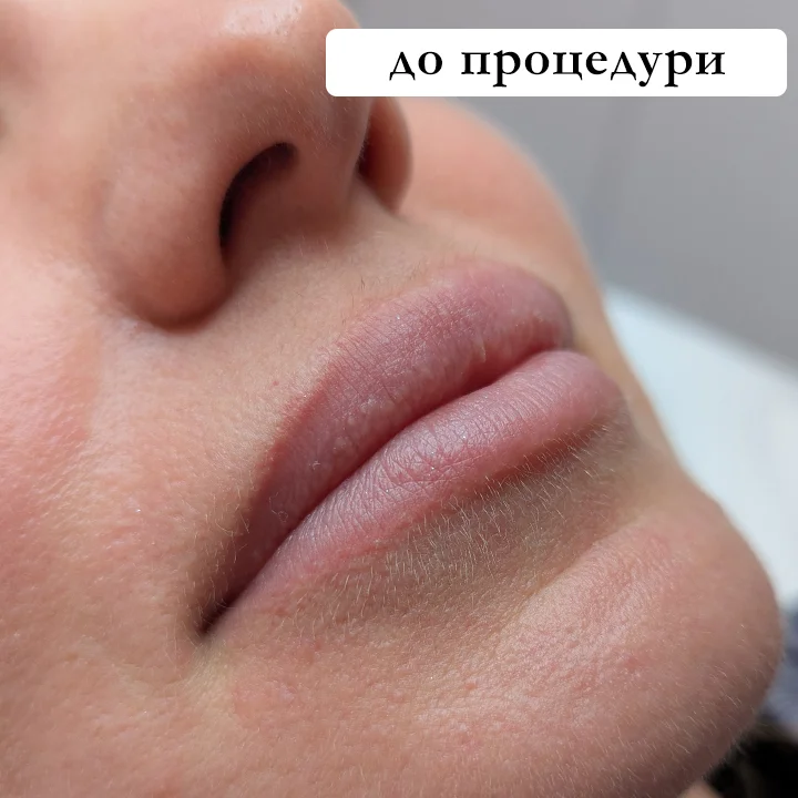 До процедури татуажу. Львів