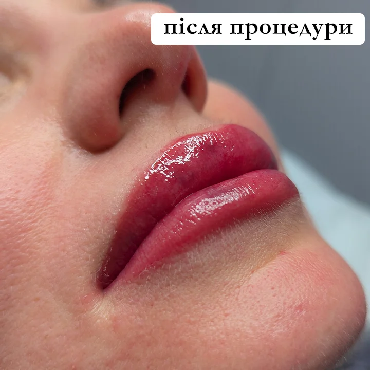 Результат після татуажу. Львів