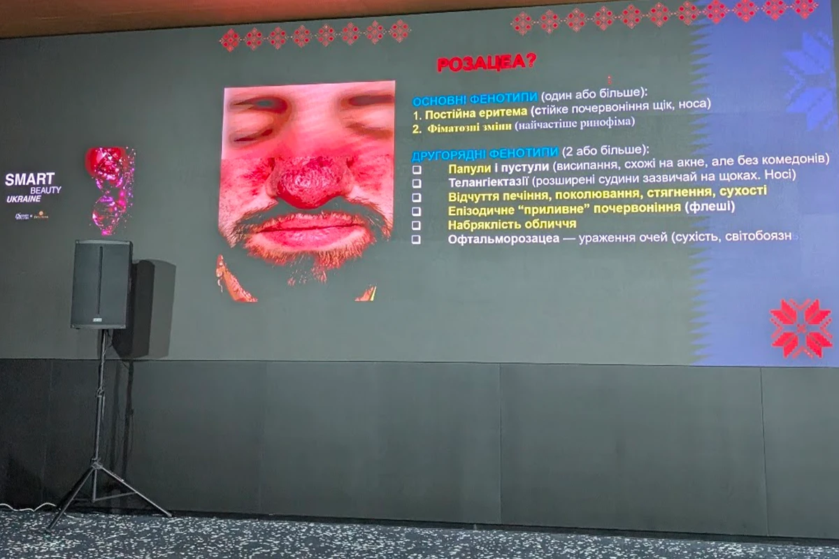 Діагностика проблеми косметологом