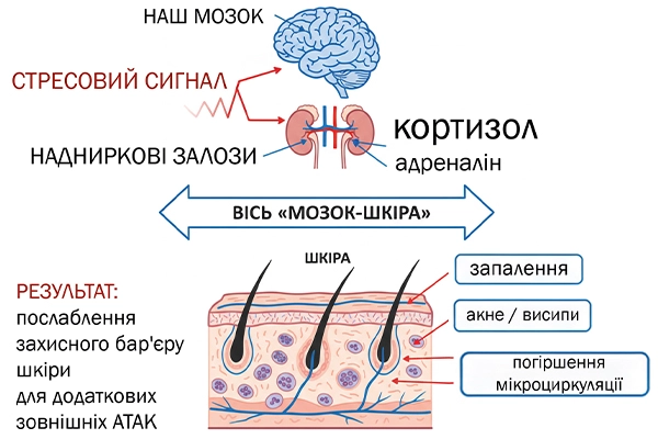Стрес та шкіра. Поради косметолога