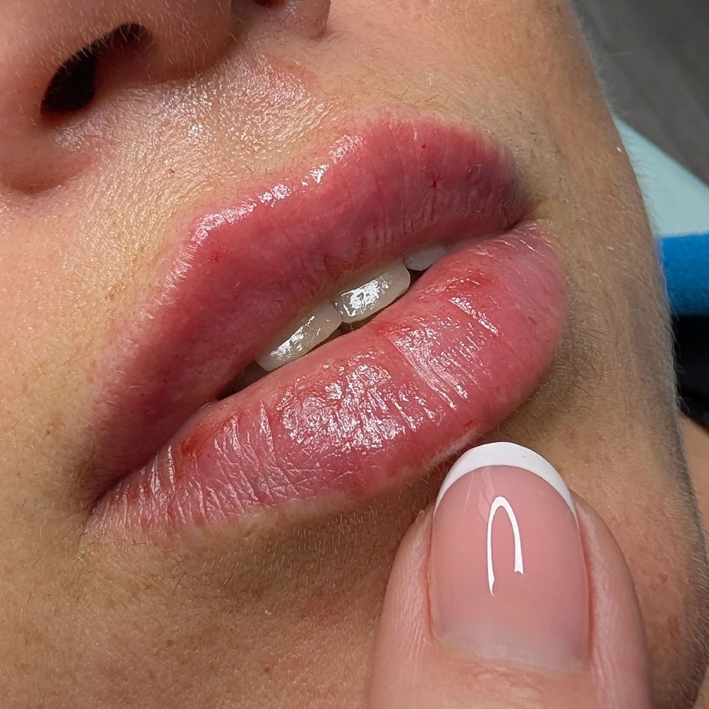 Ідеальні губи: контур та об'єм, що Вам личитимуть