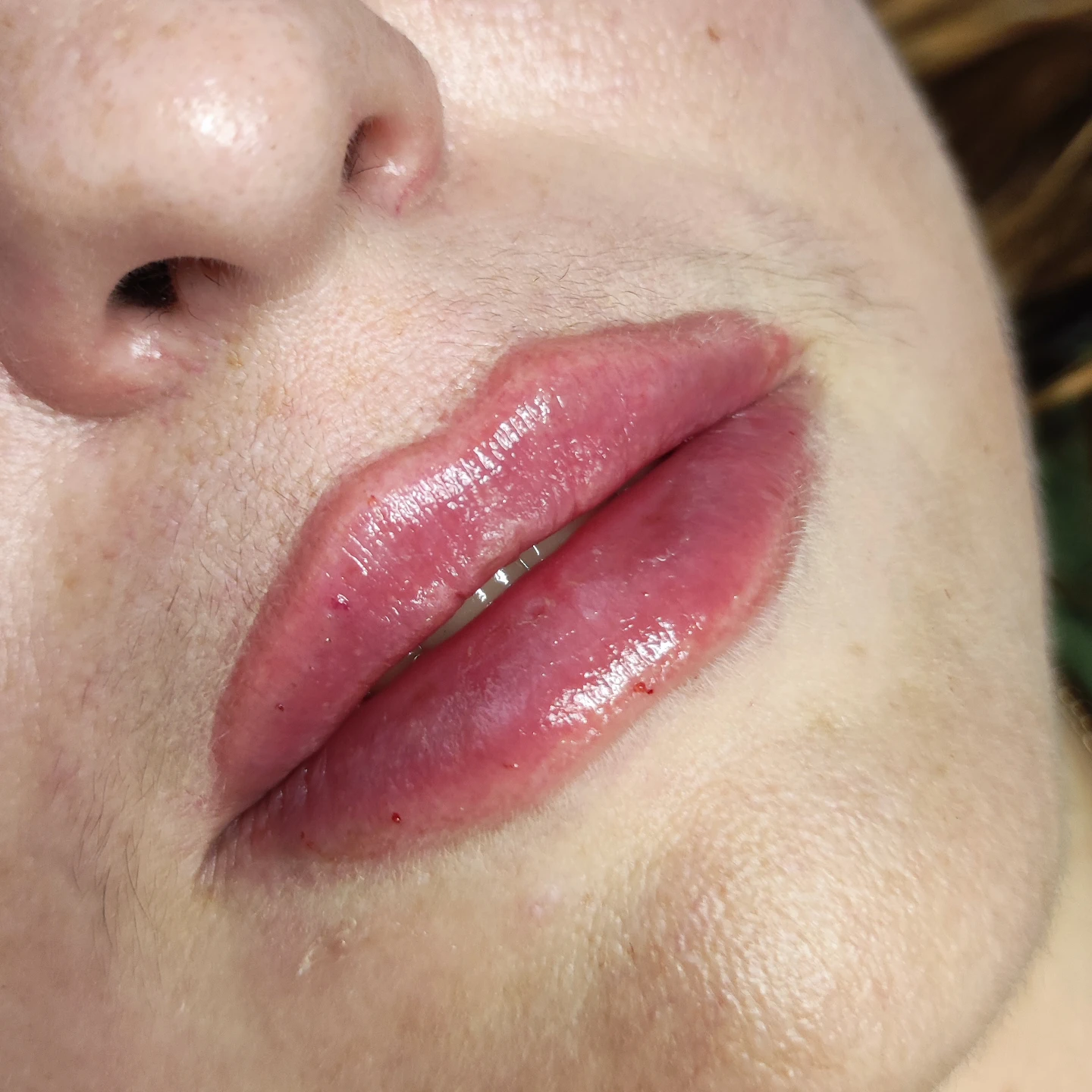 Філери для губ