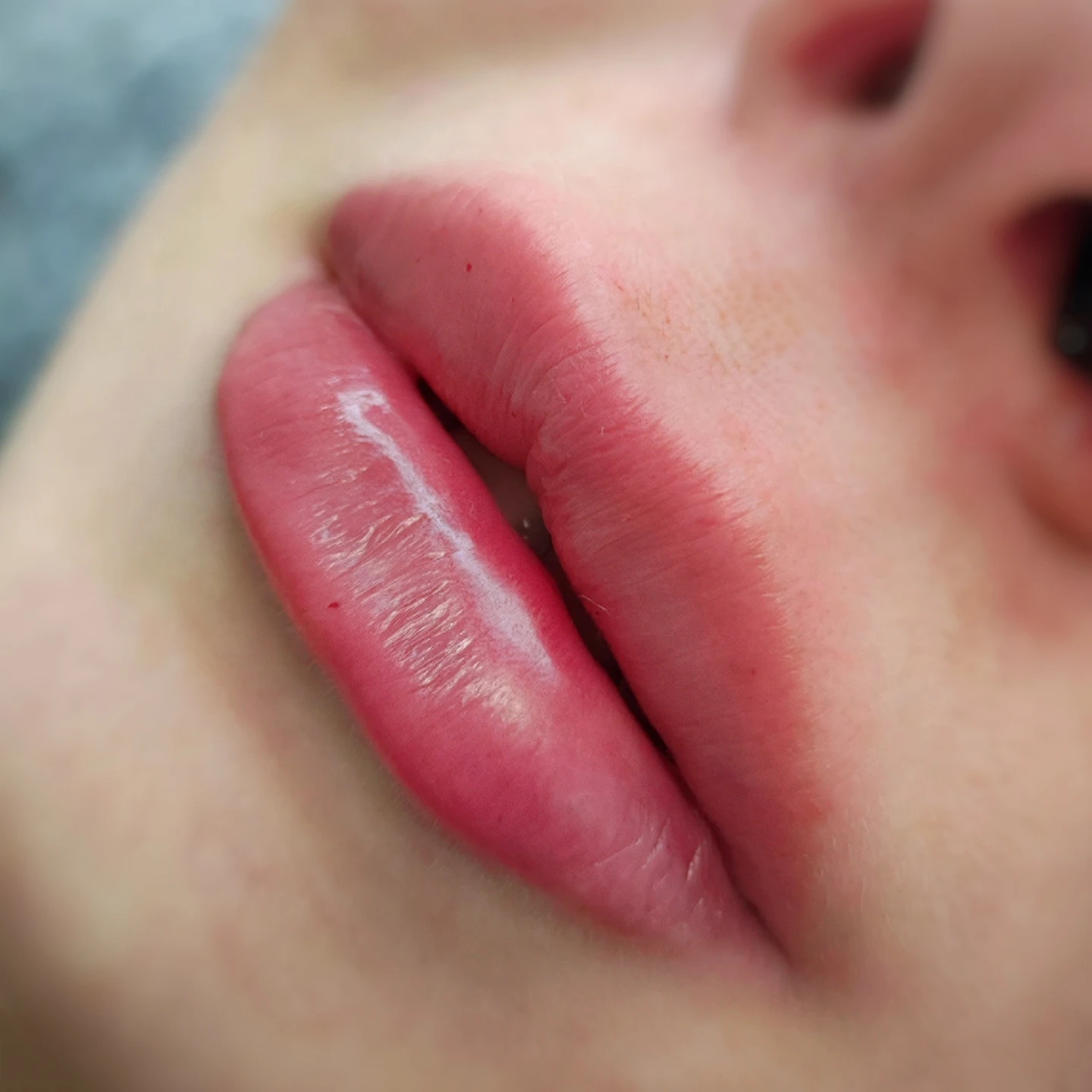 Уколи краси у Львові