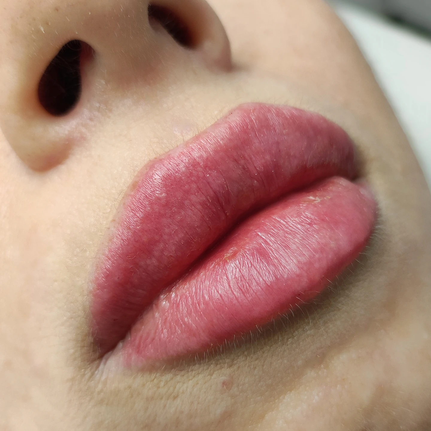 Пухкі губи у Львові. Косметолог Наталія Філь