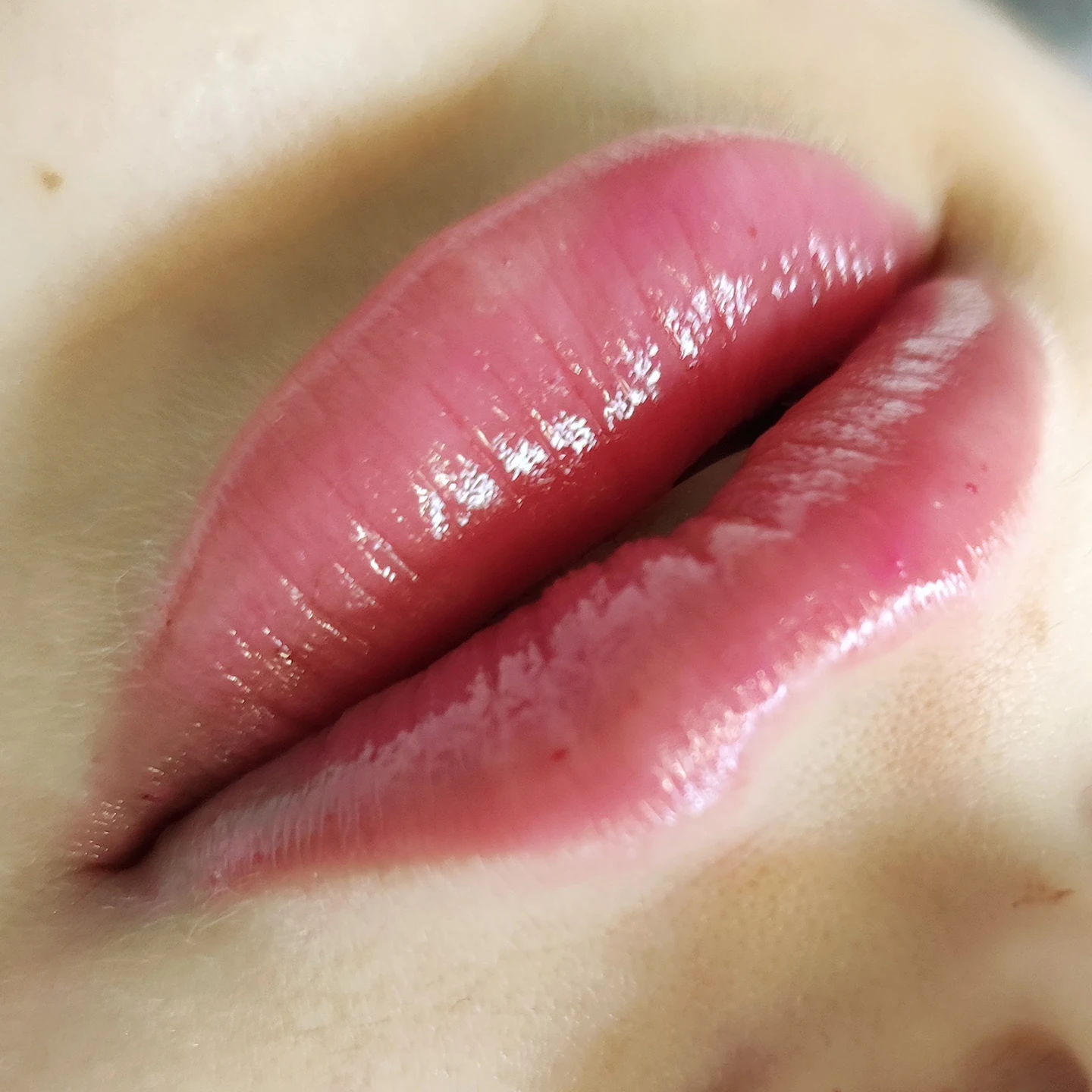 Уколи краси у Львові