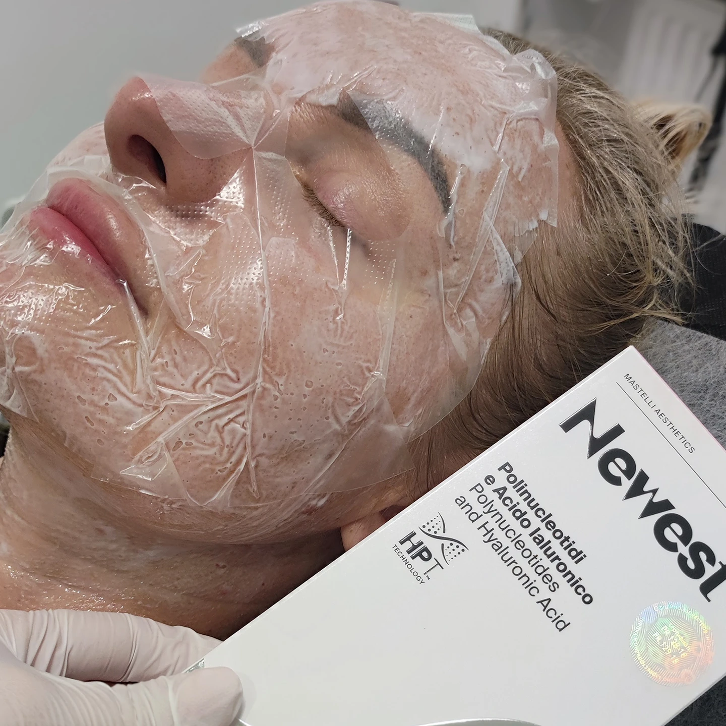 Біоревіталізація. Львів