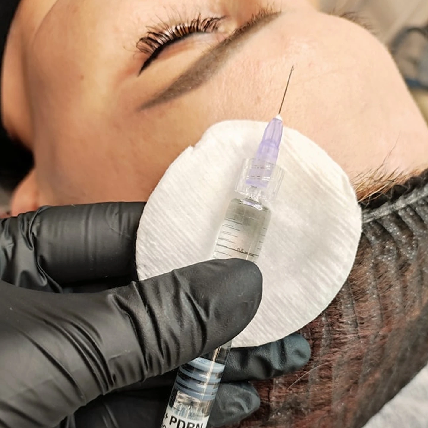 Глибоке зволоження: Біоревіталізація у Львові