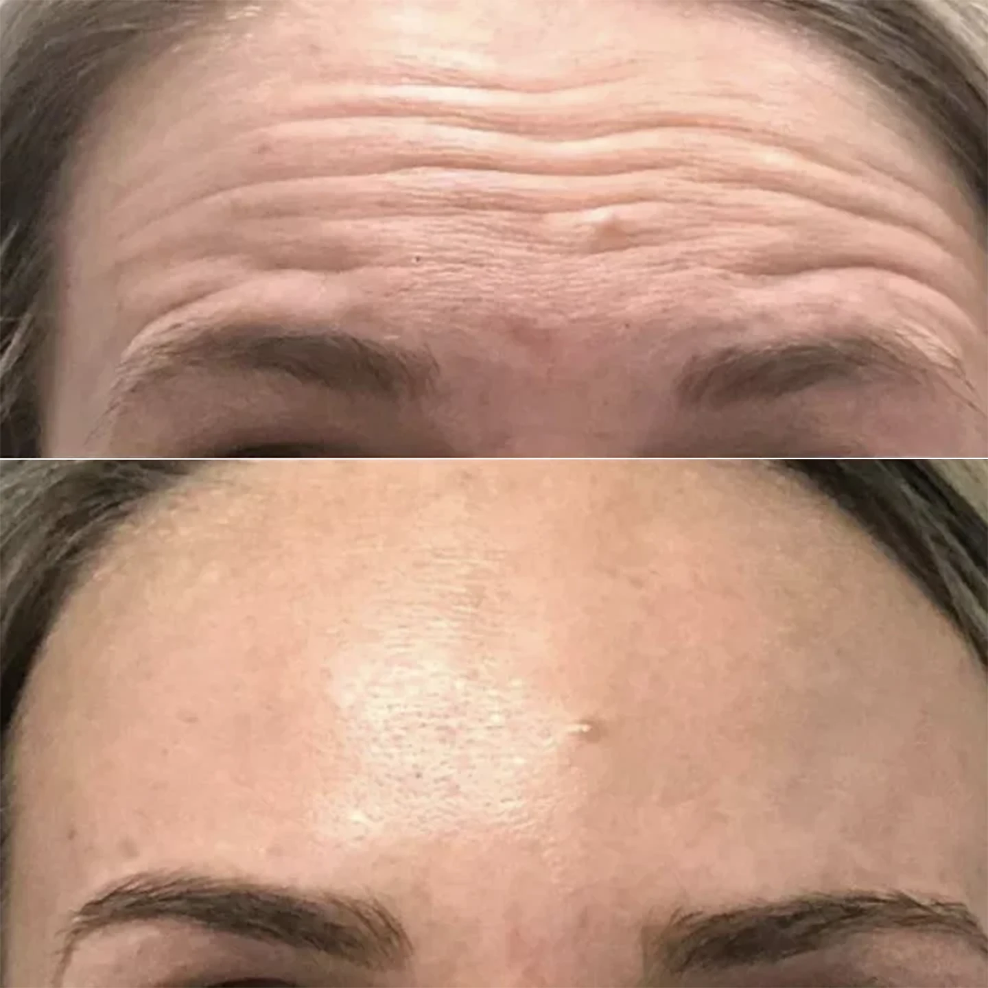 Омолодження у Львові