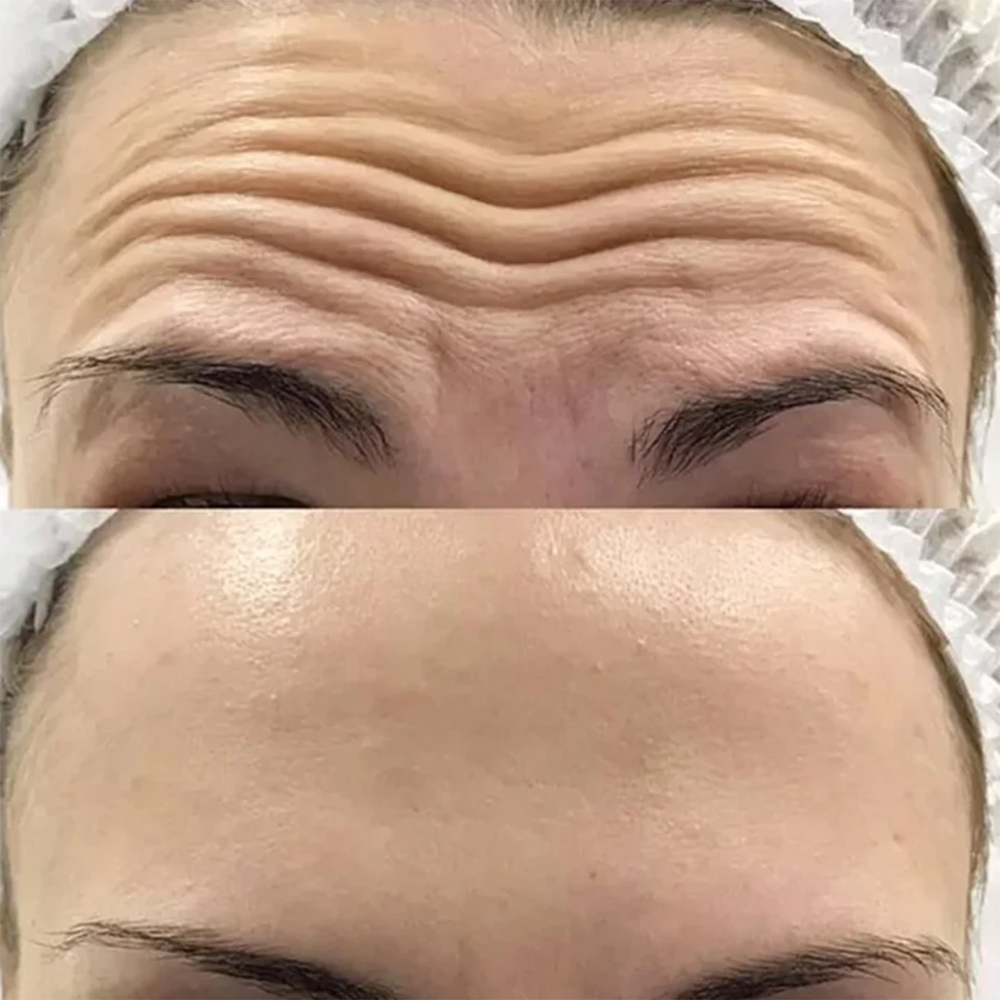 Ін'єкційна косметологія. Уколи краси у Львові.