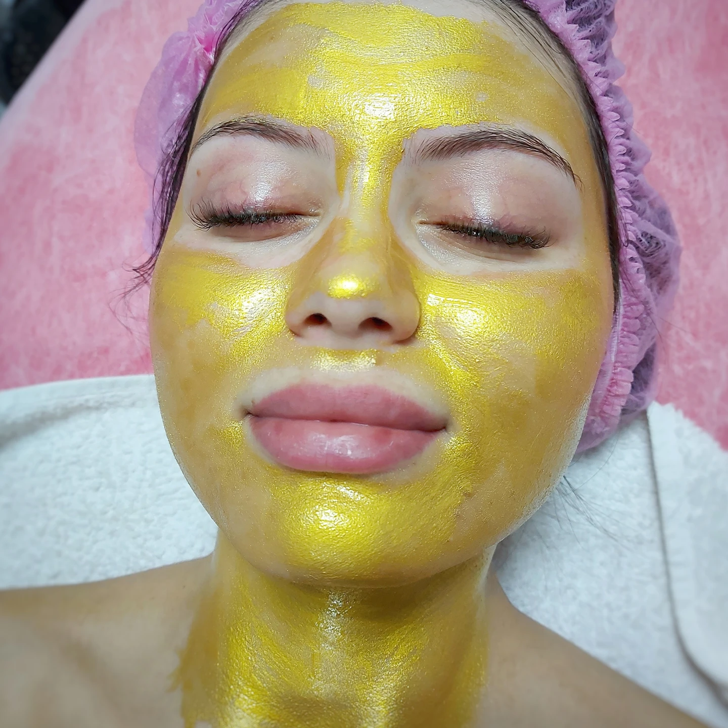 Проблемна шкіра. Догляд за обличчям у Львові