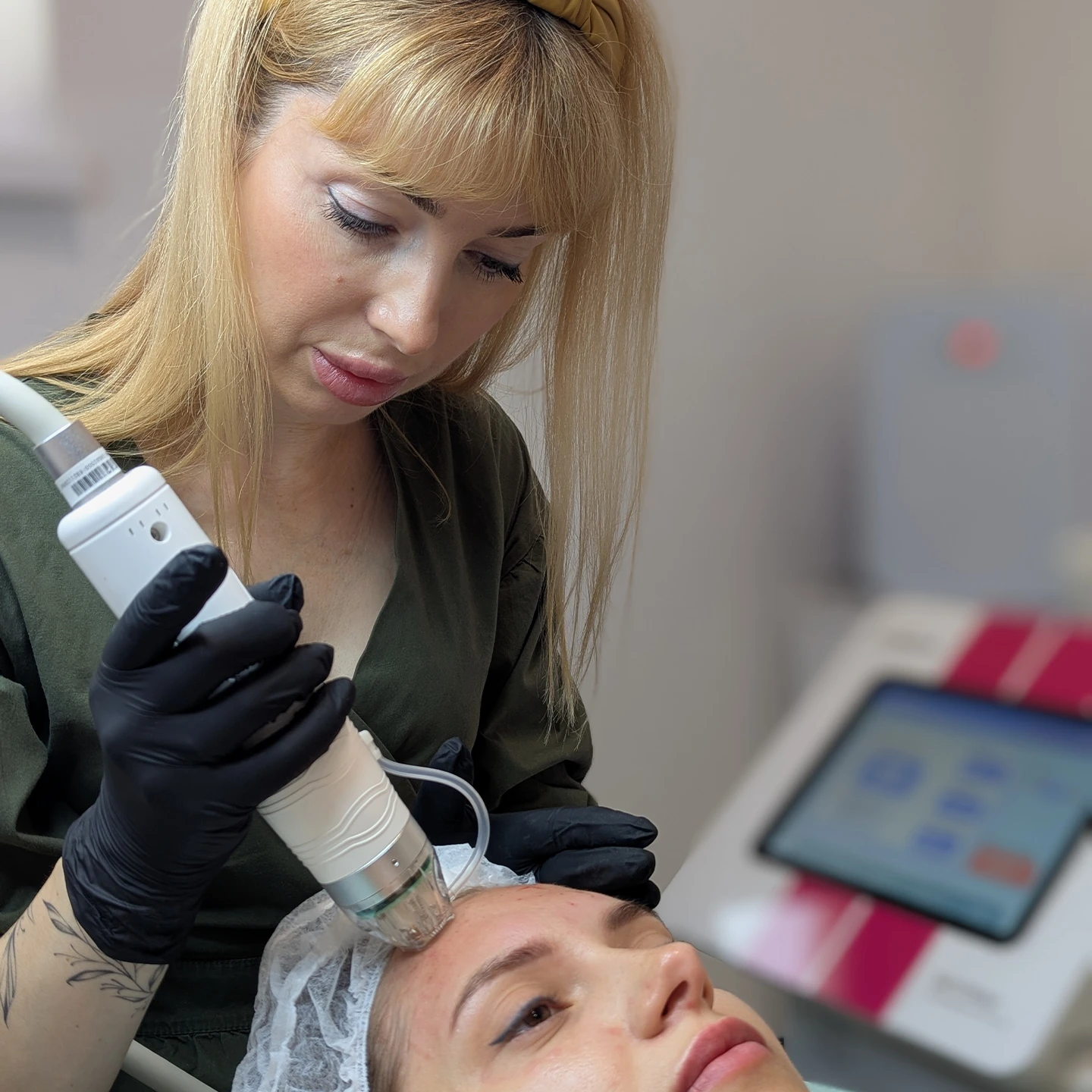 мікроголковий рф ліфтинг у Львові