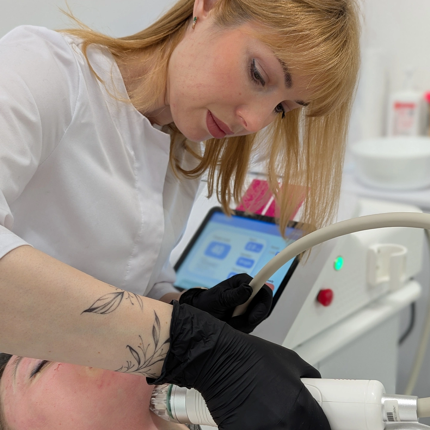 мікроголковий рф ліфтинг. Наталія Філь. Львів