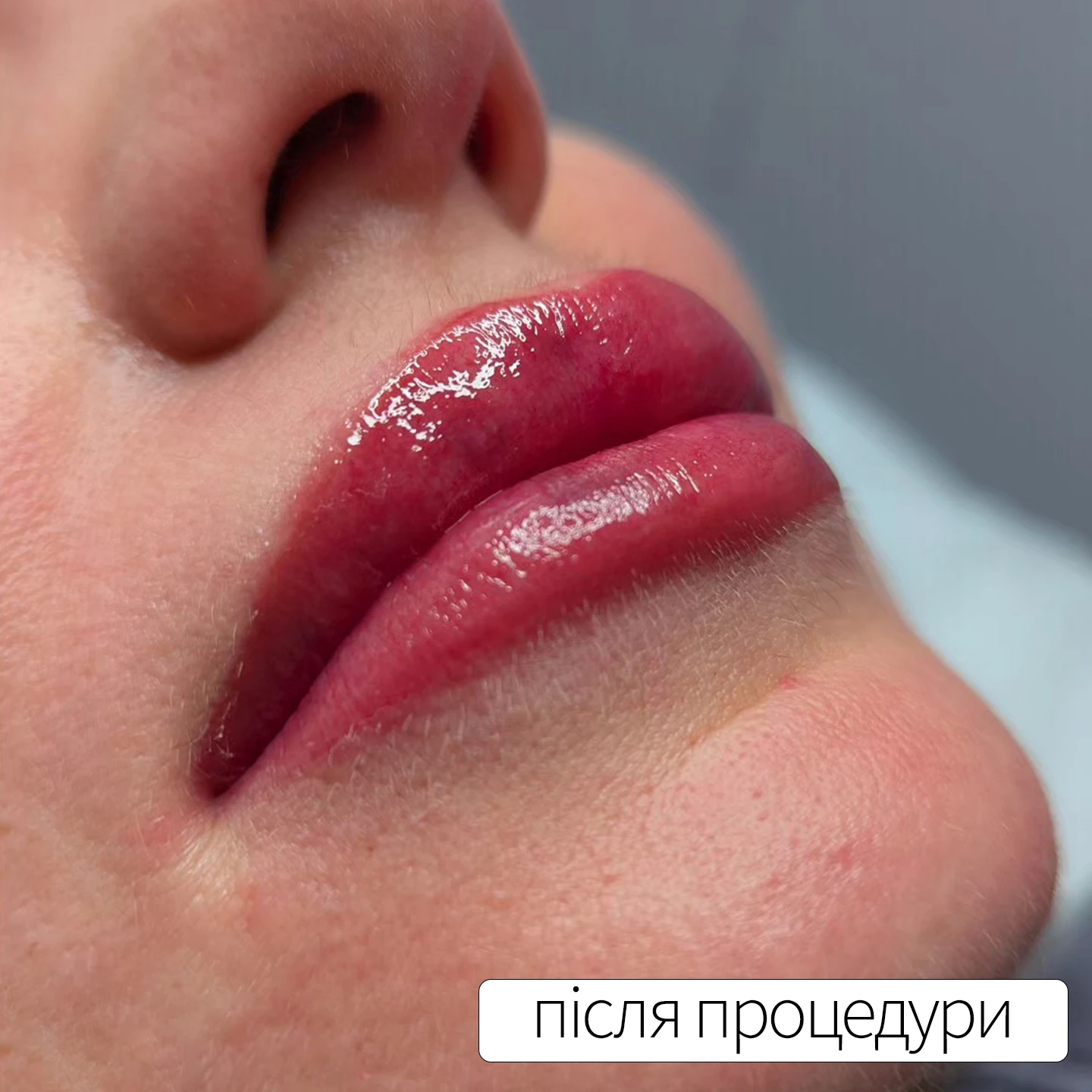 Результат після татуажу губ. Львів