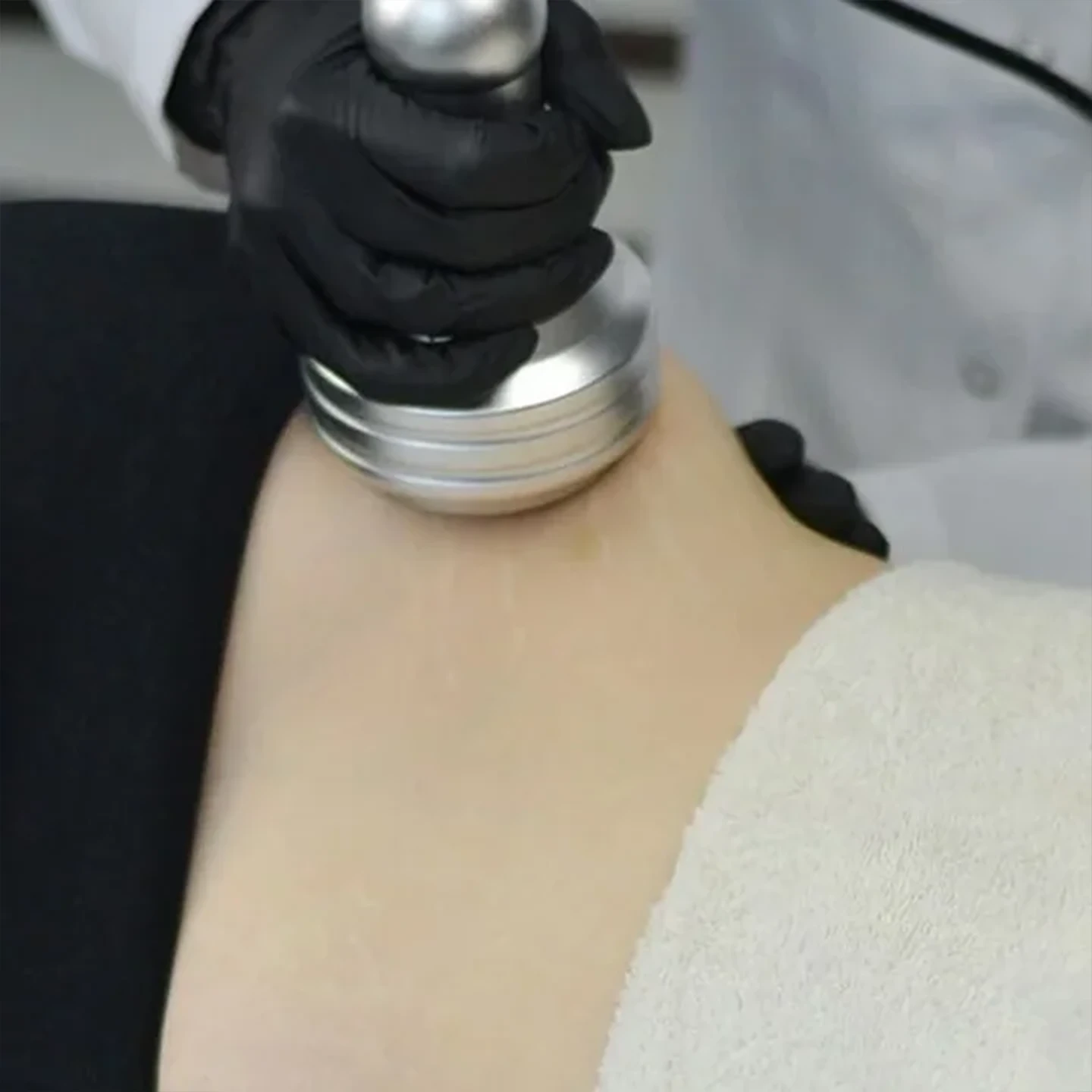 Підтяжка шкіри. Львів